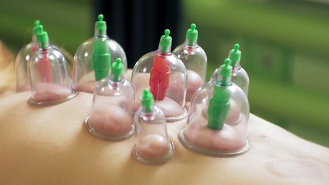 Accredited Higher Diploma in Hijama Cupping Therapy Course