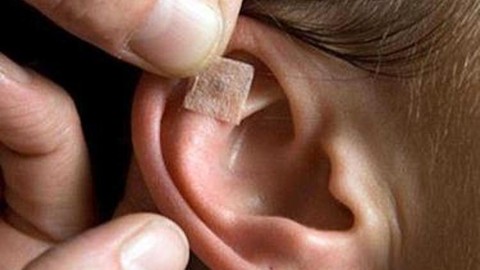 Auriculoterapia Bsica