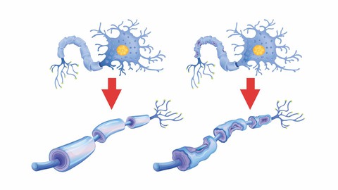 Biology - Neural Control & Coordination