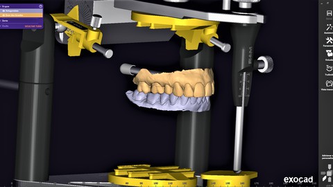 Digital flow in dentistry and basic exocad program